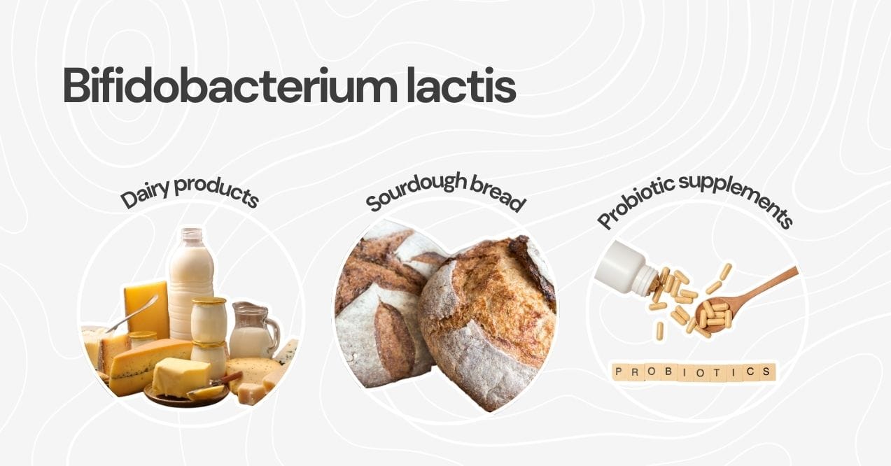 Dairy products, sourdough bread, and probiotic supplements rich in Bifidobacterium lactis.