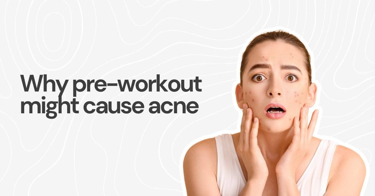 Woman with acne looking concerned, touching her face.